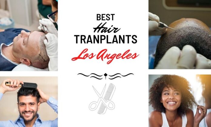 best hair transplants in Los Angeles